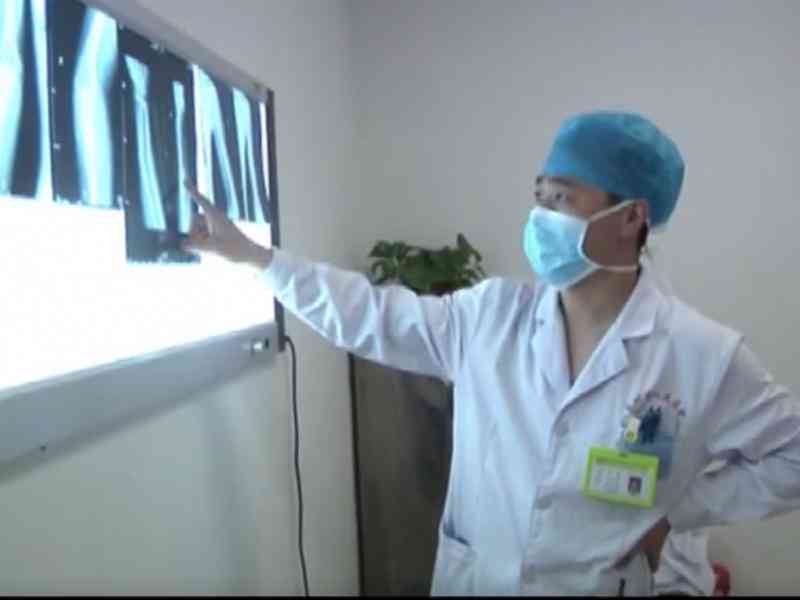 工伤残疾等级评定：医生如何精准判断与分类