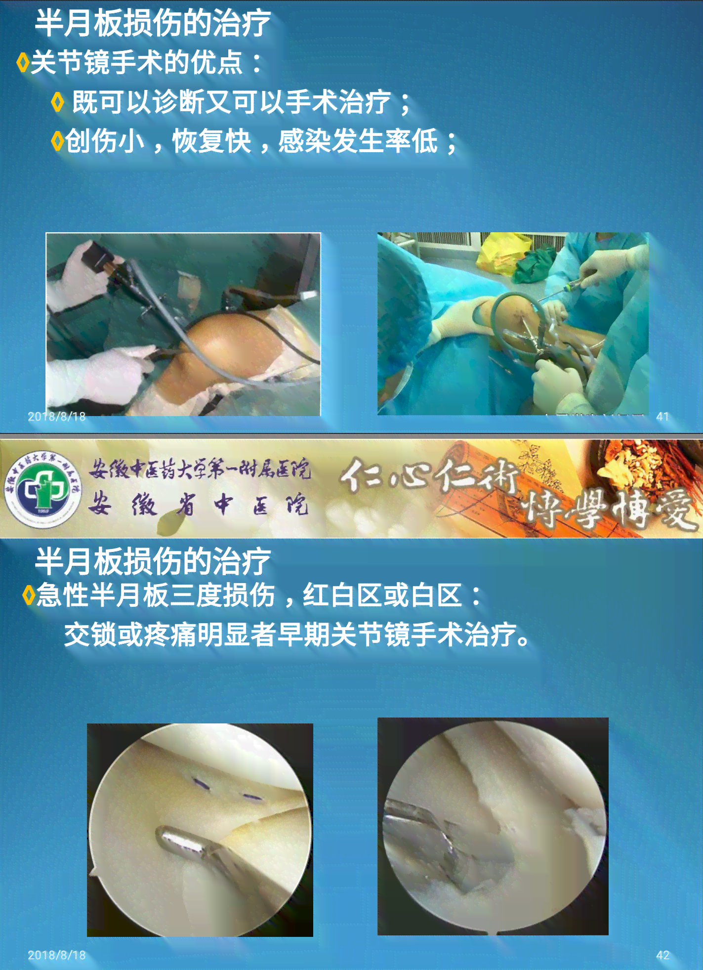 半月板手术能认定工伤吗