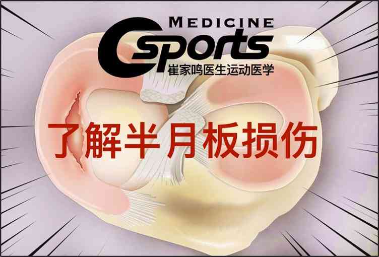 半月板手术能认定工伤吗