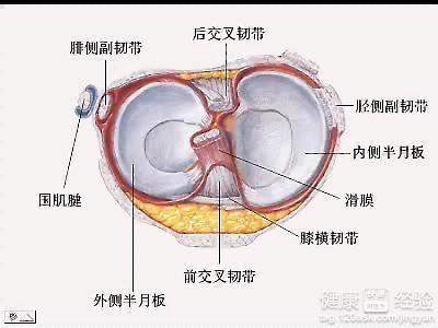 工作中半月板损伤是否合工伤认定标准