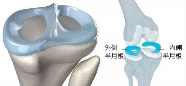 膝关节半月板损伤工伤认定标准与赔偿级别解析