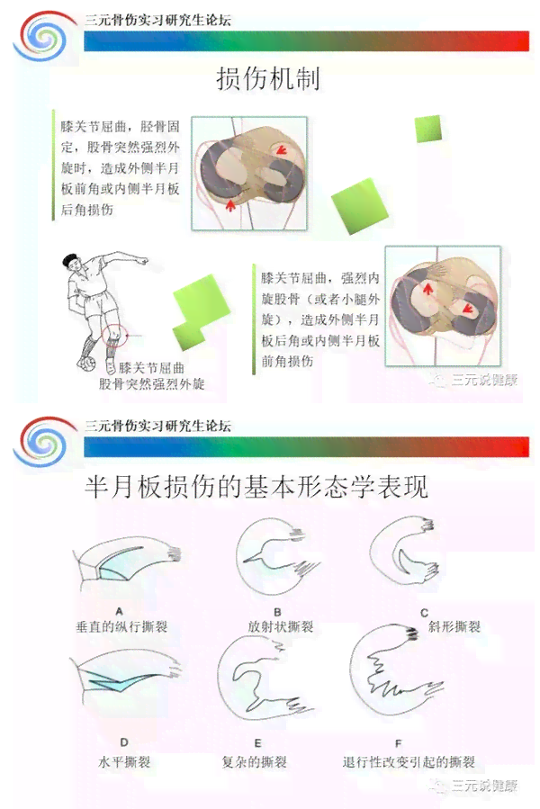 '探讨半月板损伤在职业活动中是否构成工伤认定标准'