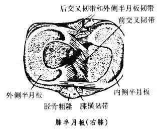半月板损伤认定工伤吗