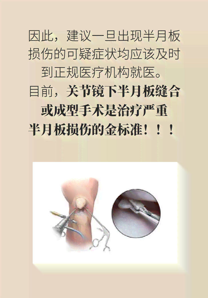 膝关节半月板损伤职业伤害工伤认定标准解读