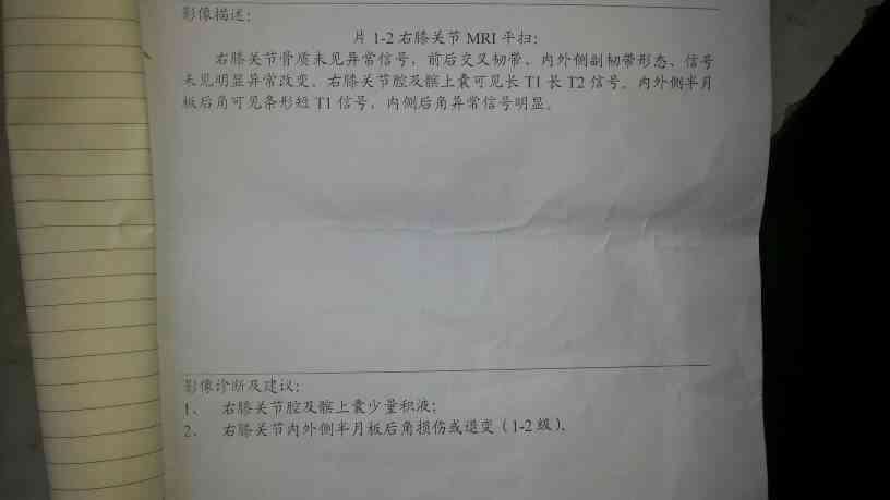 半月板认定工伤