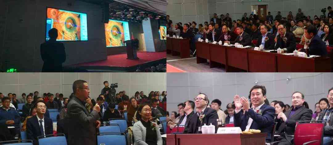 AI驱动的眼底照相机：深度解析智能诊断报告的奥秘