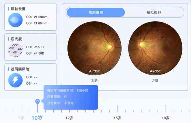 深入解读AI眼底照相机报告：全面指南教你如何准确解析眼部健信息
