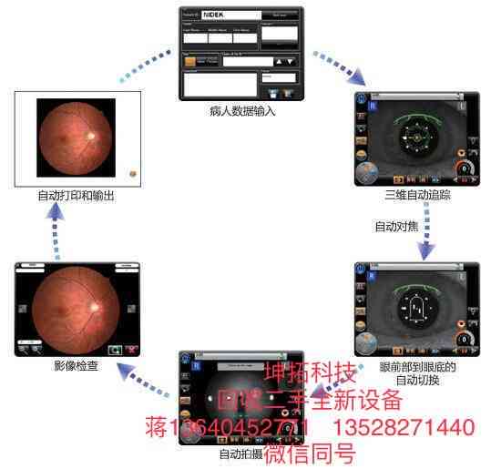 眼底照相机的ai报告在哪里看：详解AI眼底照相机检查与报告阅读