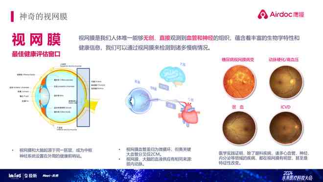 眼底照相机的ai报告在哪里看：详解AI眼底照相机检查与报告阅读