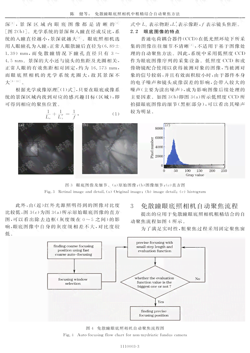 眼底照相机的ai报告在哪里看：详解AI眼底照相机检查与报告阅读