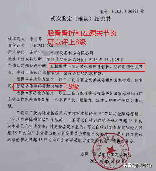 工伤等级鉴定全解析：受伤后何时进行鉴定及所需条件和流程