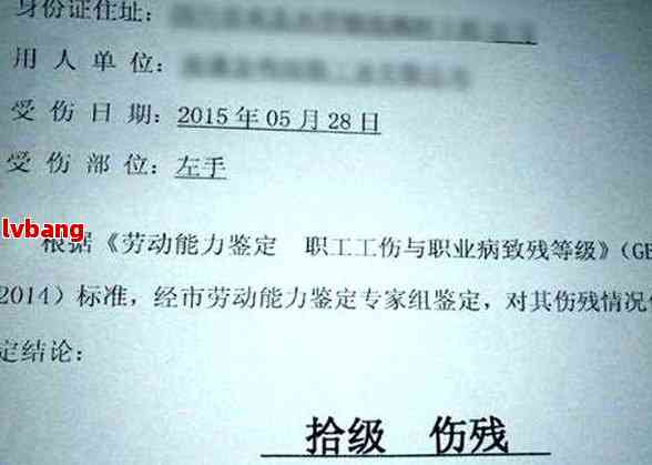 只有病历可以认定工伤吗
