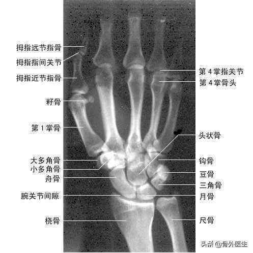 右腕关节损伤能认定工伤吗多少钱天月及病因解析