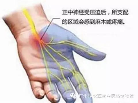 右侧手腕关节损伤：诊断、治疗与复指导