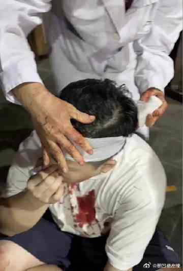 下班高峰期工人餐厅内突发脑出血意外