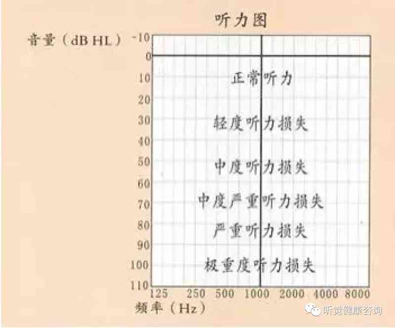 听力损失30分是否算作聋：深入了解听力阈值与耳聋标准