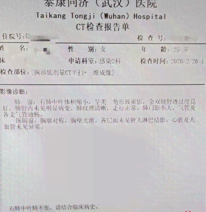 30分双耳听力检测结果是否属于正常范围
