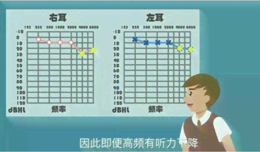 双耳听力35分严重吗：耳朵听力正常值与30分对比分析
