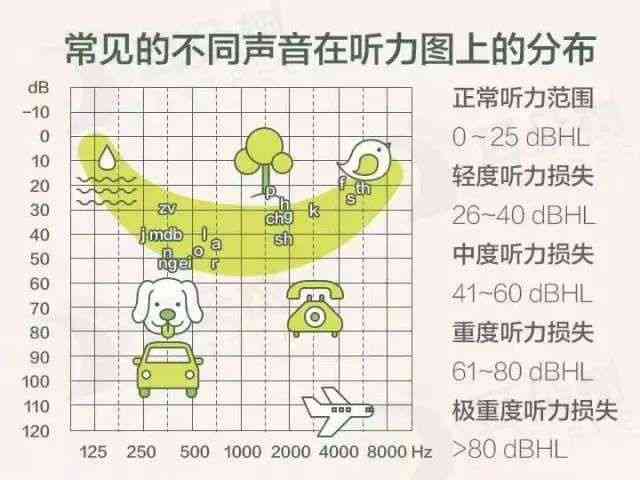 听力损失低于40分：双耳听力评估新标准
