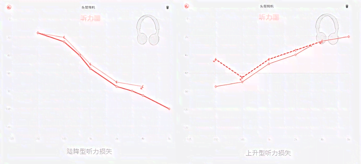 双耳听力30分：评估听力损失程度及其影响