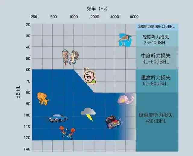 听力障碍残疾等级划分及评定标准详解
