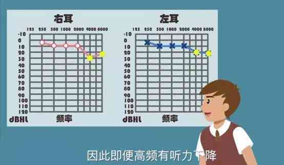 高频听力损失可以评残吗：损失50dB会自愈吗，多久可能致聋？