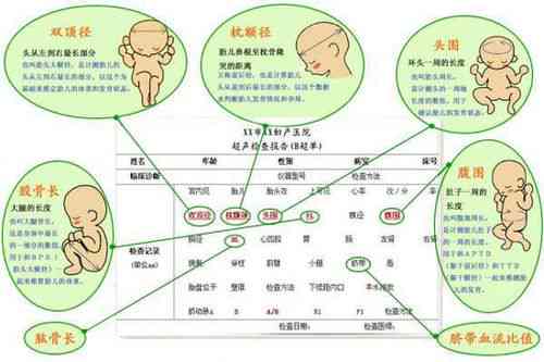 彩超报告中的AC含义及胎儿发育情况综合解读