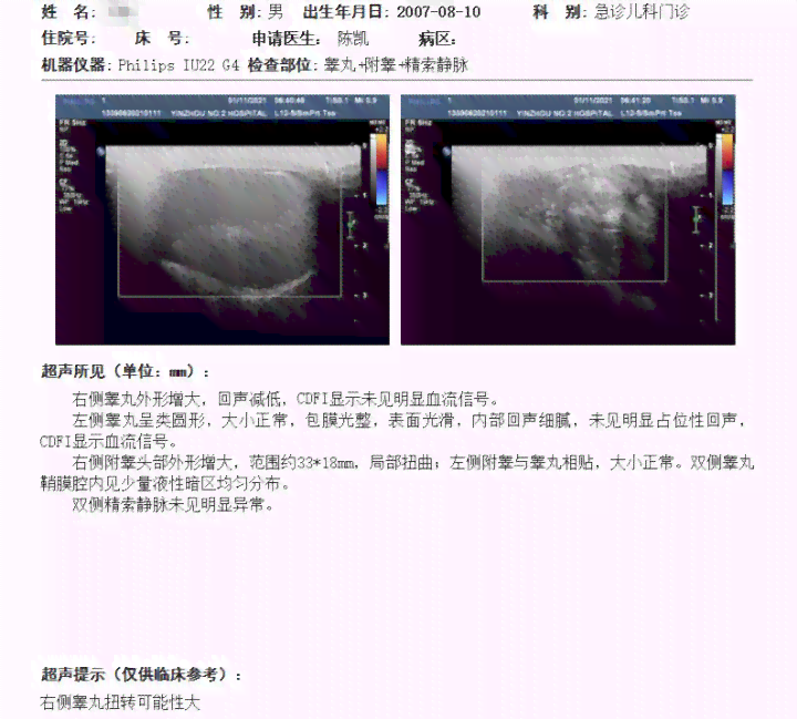 彩超报告AO：如何解读AC含义、查看报告单及等待结果时长