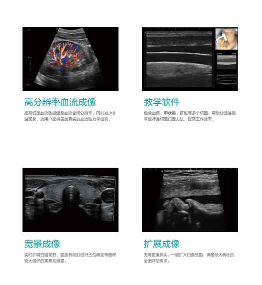 彩色多普勒超声检查报告：AC分析与解读