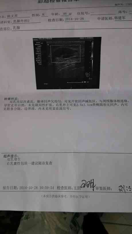 彩超报告一般要等多久出结果：乳腺彩超多久出正常报告