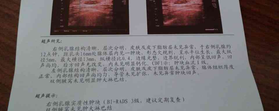 彩超报告一般要等多久出结果：乳腺彩超多久出正常报告