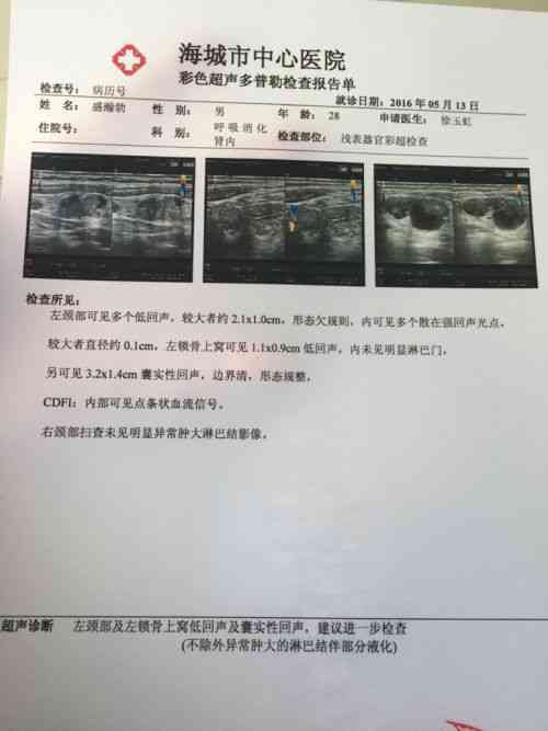 彩超报告一般要等多久出结果：乳腺彩超多久出正常报告