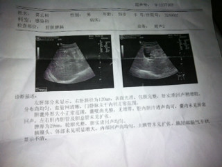 彩超报告一般要等多久出结果：乳腺彩超多久出正常报告