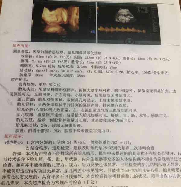 彩超报告ai