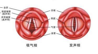 咽喉息肉是否会恶变：探讨其癌变风险与预防策略