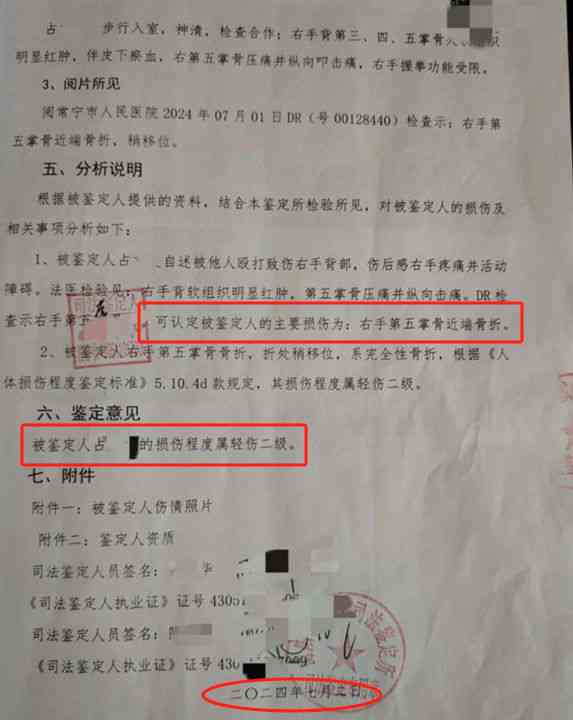喀县认定工伤在哪做的