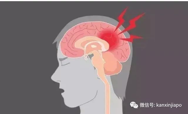 回家途中突发脑出血算不算工伤：包括回家路上脑溢血情况探讨