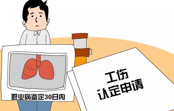 工伤认定标准：单位工作时间内如何准确计算工伤时间