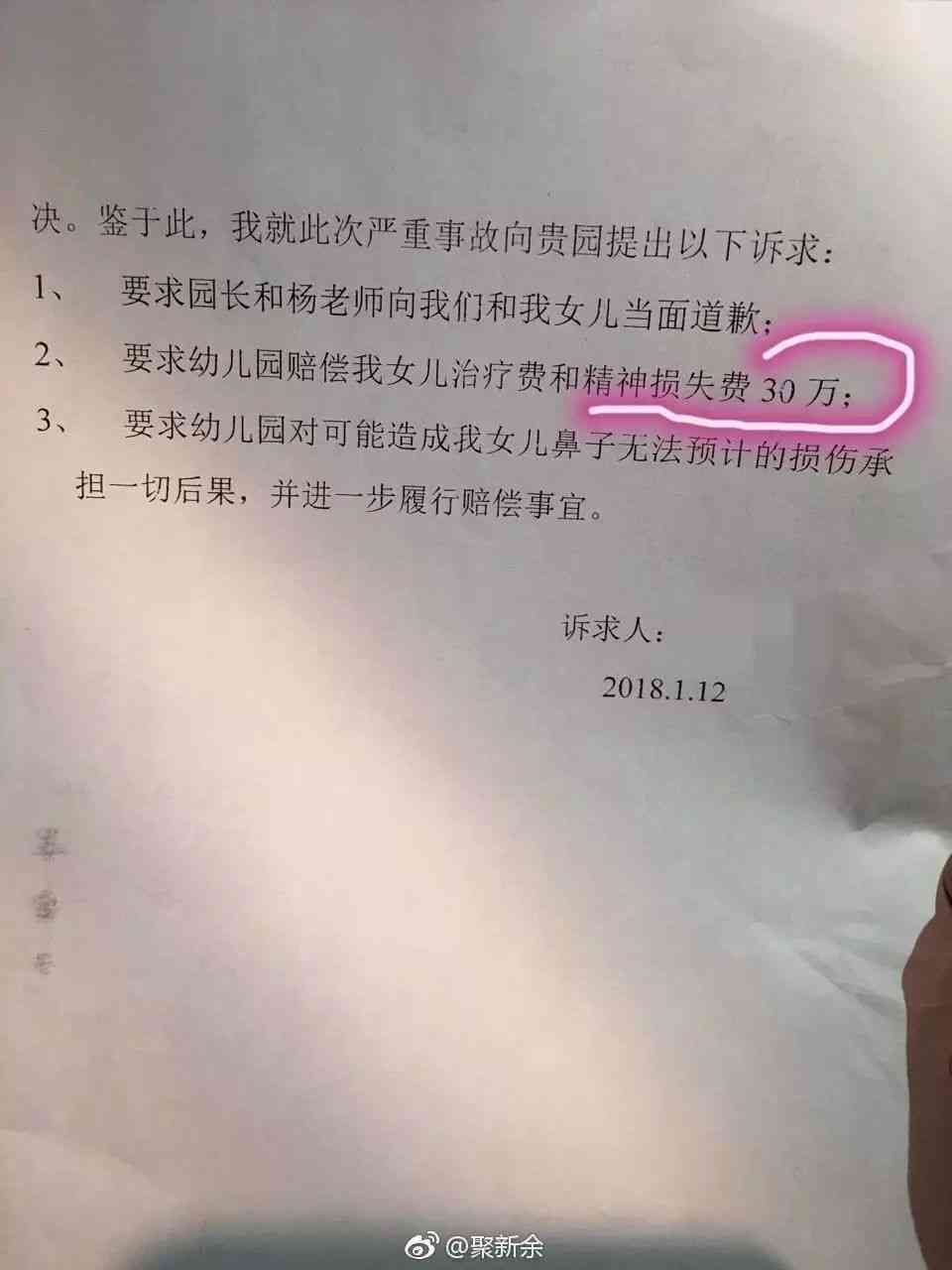 在宿舍被打伤公司有责任吗：公司宿舍受伤如何索赔与赔偿标准