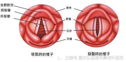 声带息肉：工伤认定的标准、流程与相关权益详解