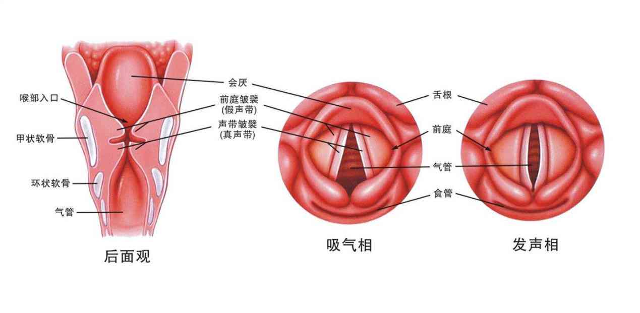 声带小结是否属于工伤范畴：职业嗓音疾病认定探讨