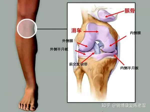 长期忽视：复发性髌骨脱位不手术可能导致的严重后果