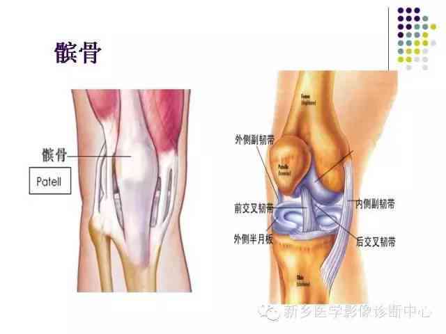 全面解读复发性髌骨脱位：症状、原因、诊断与治疗要点