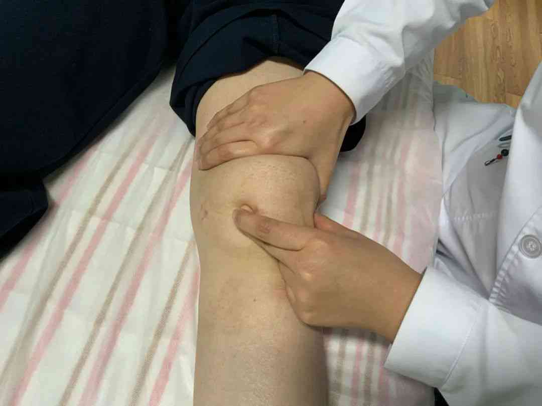 复发性髌骨脱位常见体征及症状解析与意外性质探讨