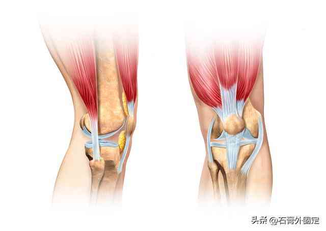探讨复发性髌骨脱位：手术治疗是否为必要选择