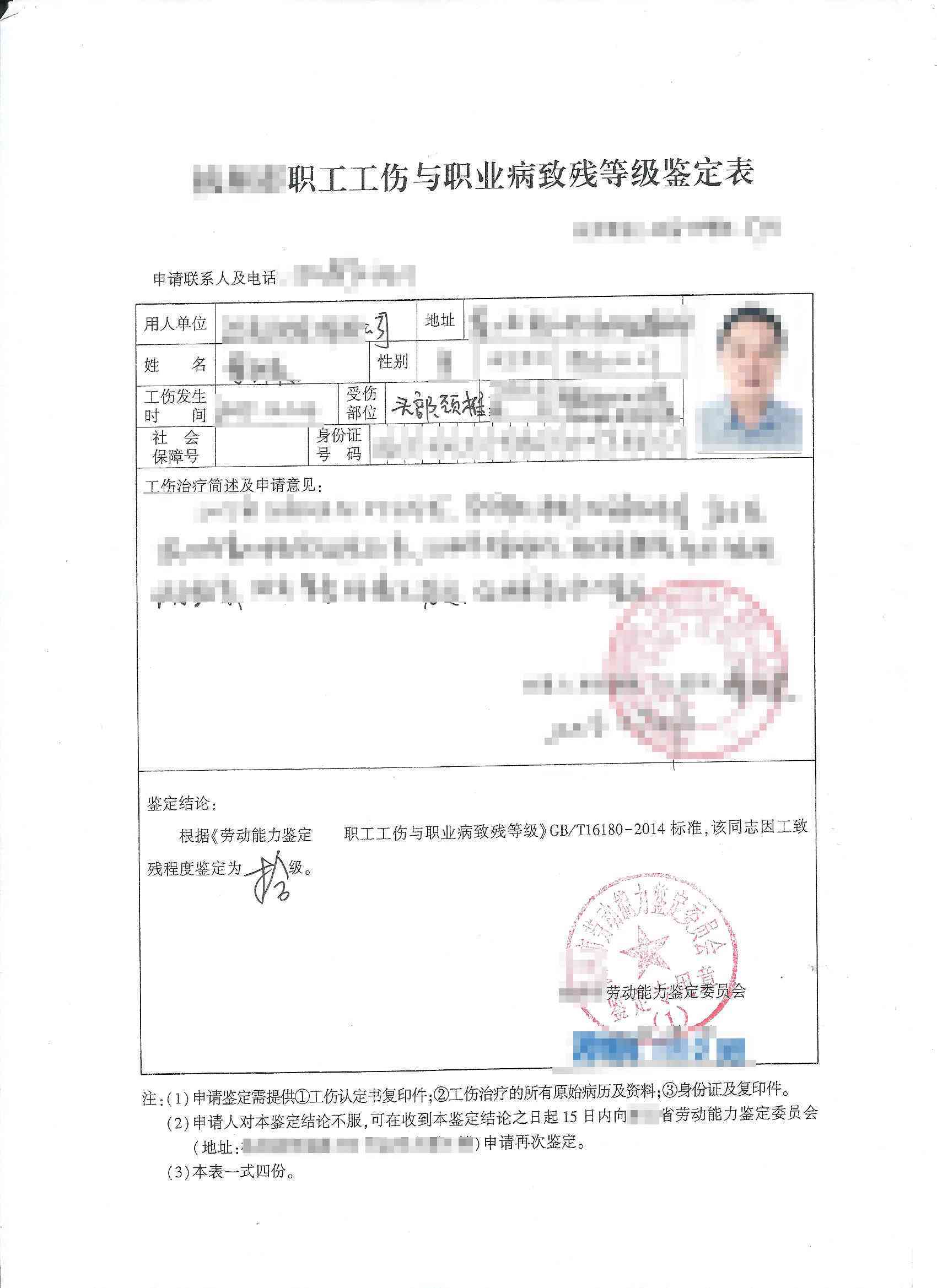 外伤造成腰突怎么认定工伤等级——腰椎间盘突出的工伤认定标准探讨