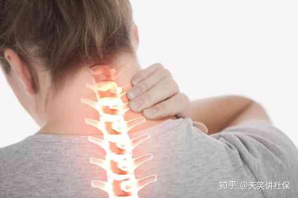 外力颈椎病才能被认定工伤