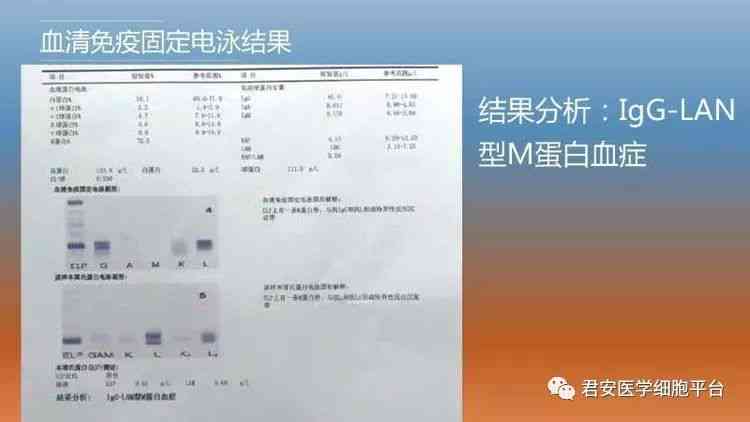 多发性骨髓瘤是职业病吗：治疗难度、认证难度及工作能力解析
