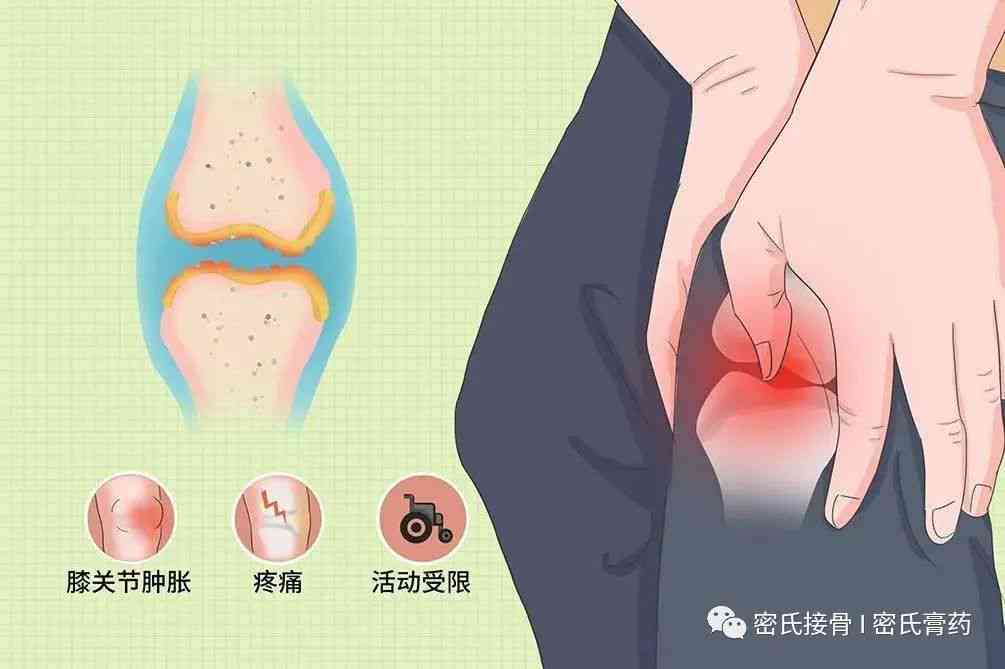 深入了解大关节脱位：原因、症状、治疗与预防全方位解析