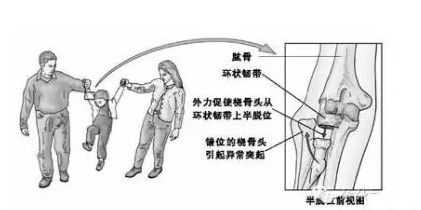 大关节脱臼可以认定工伤吗